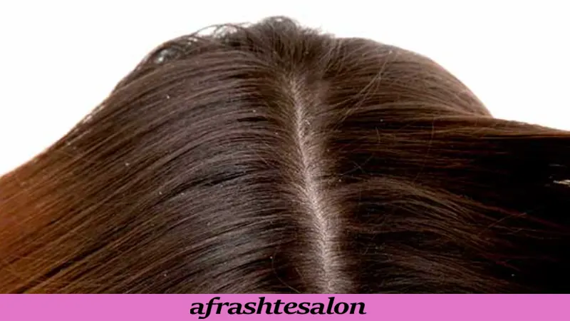 رازهای مراقبت از پوست سر