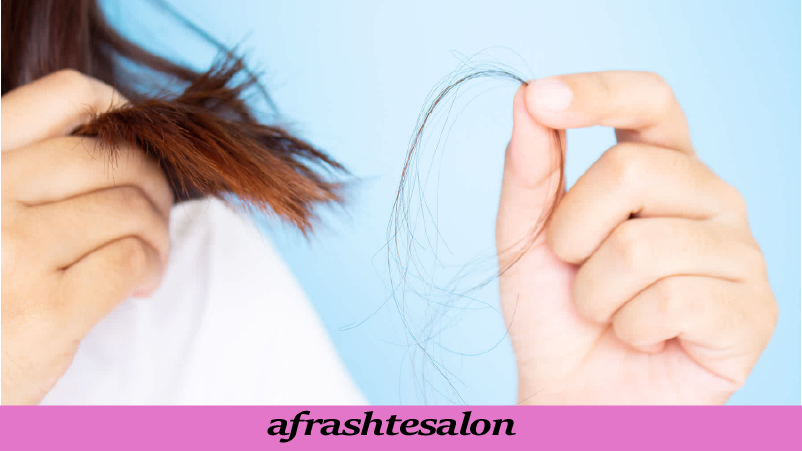 آیا استرس باعث ریزش مو میشود